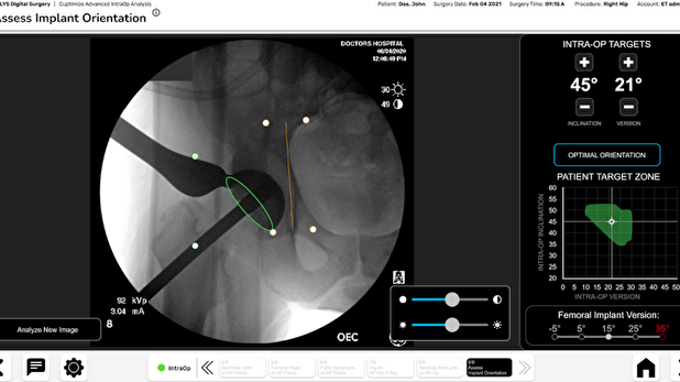 Hip Procedural Solutions | DePuy Synthes | J&J MedTech US
